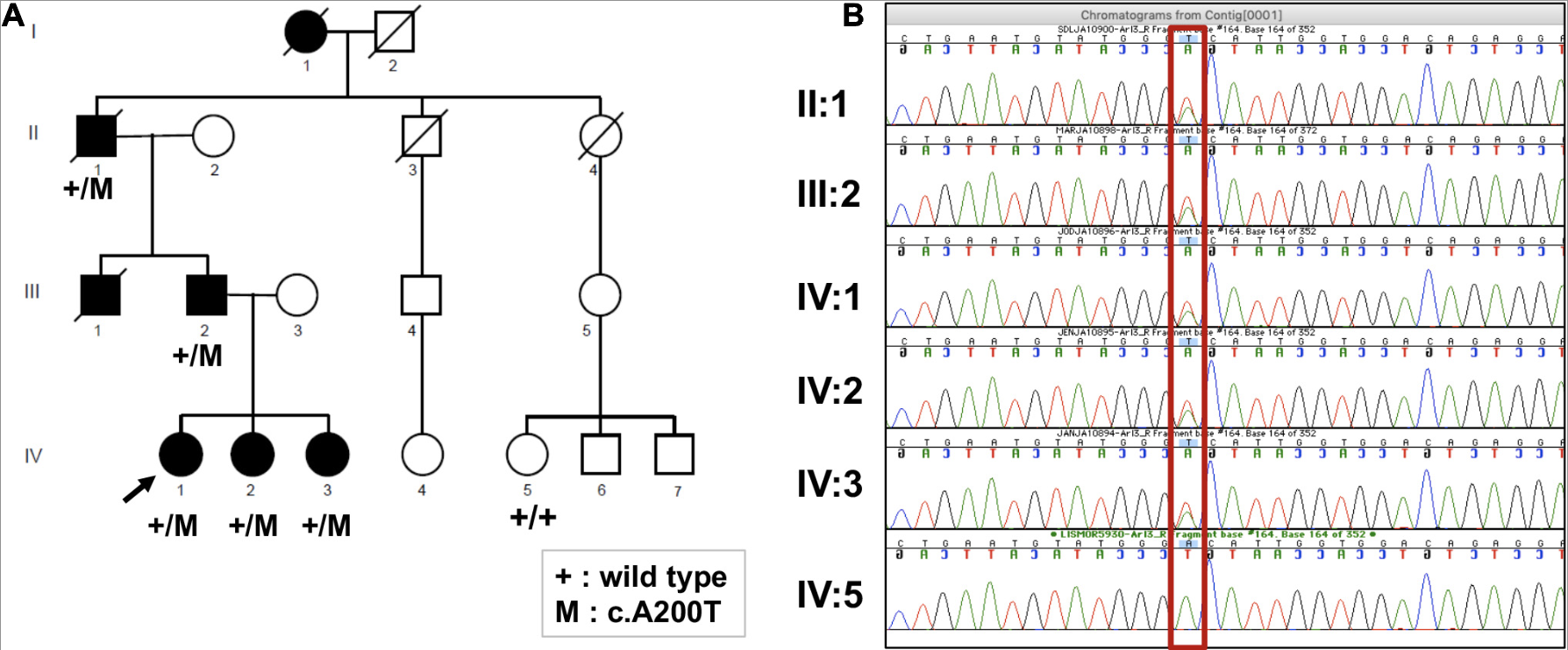Family pedigree and Sanger sequencing confirming segregation of the ARL3 c.A200T variant